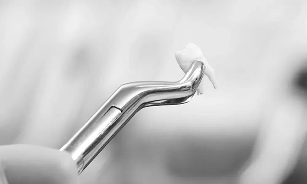 Warning Signs of Infection After Tooth Removal