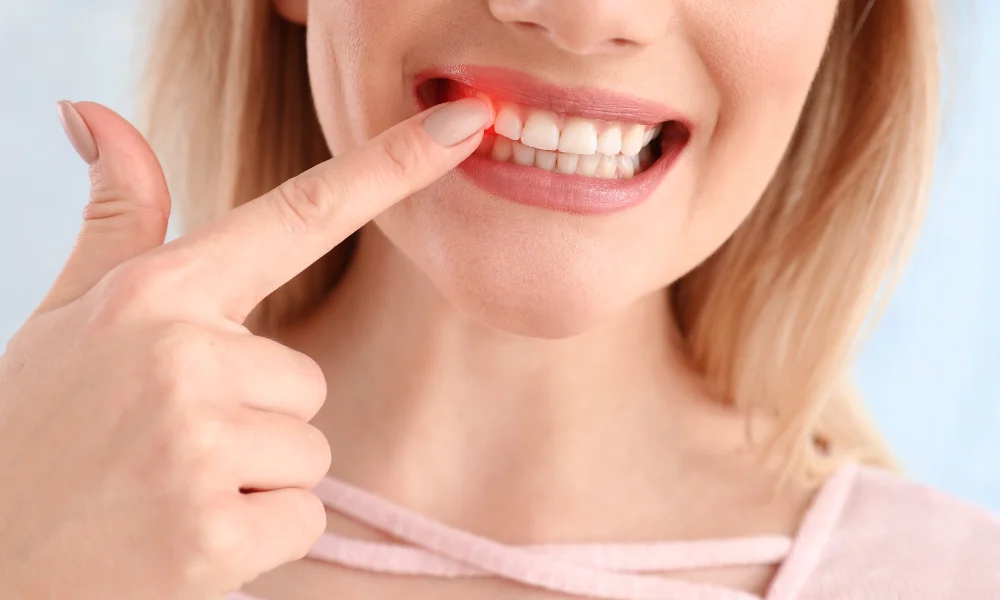 Early Signs of Tooth Decay Most People Miss